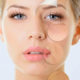 arrugas-de-expresión-hidratación-flacidez-tratamiento-facial-belleza