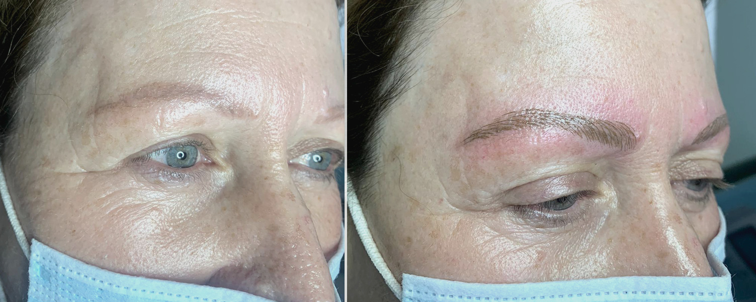 Antes y después de microblading pelo a pelo en Elche - Body Zenter